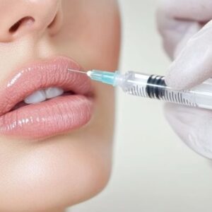 advanced dermal filler techniques near me for safe and effective results in Canton, Michigan, lip filler near me Canton Michigan