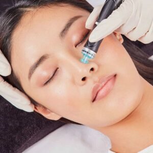 Licensed Aesthetician Performing Hydrafacial Procedure On Woman