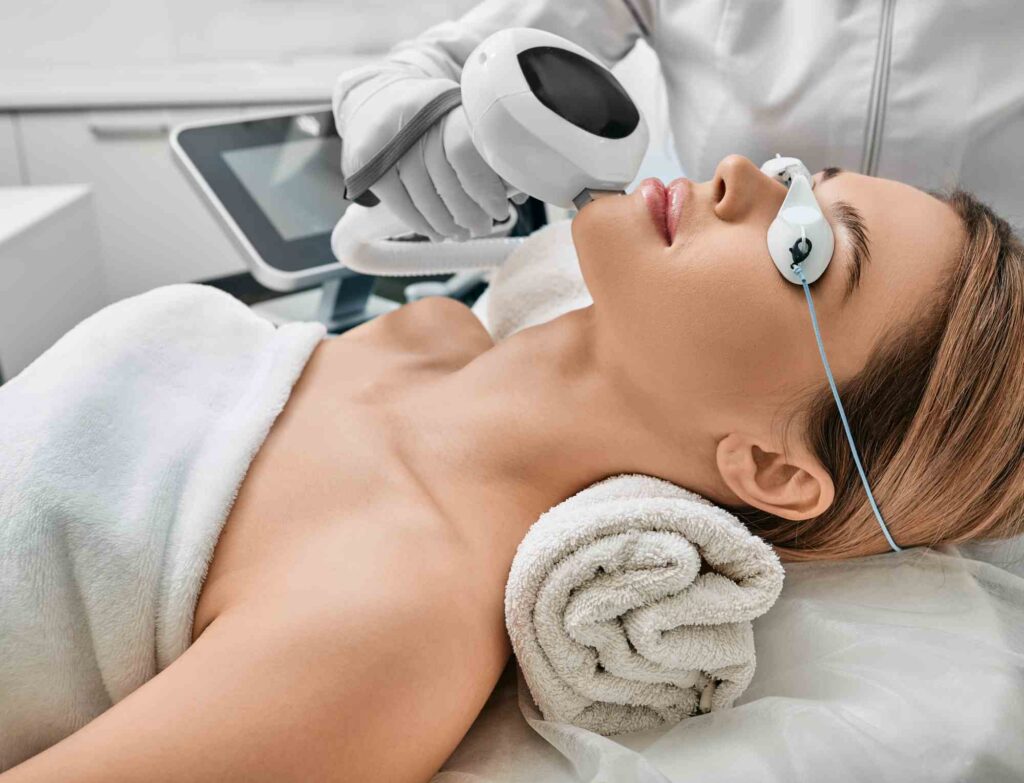 IPL treatment in canton mi