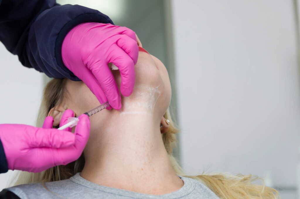 Kybella treatmeant double-chin